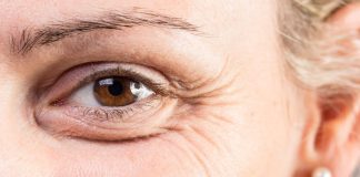 Care sunt ingredientele cele mai bune în lupta cu ridurile?